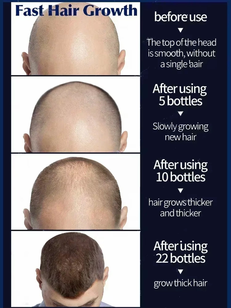Hair Growth Essential Loss Regrowth Treatment Strengthens Hair Nourishes Scalp Light Weight Non Greasy Improve Scalp Circulation